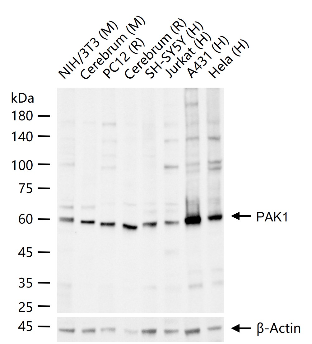 p21激活激酶1重组兔单抗