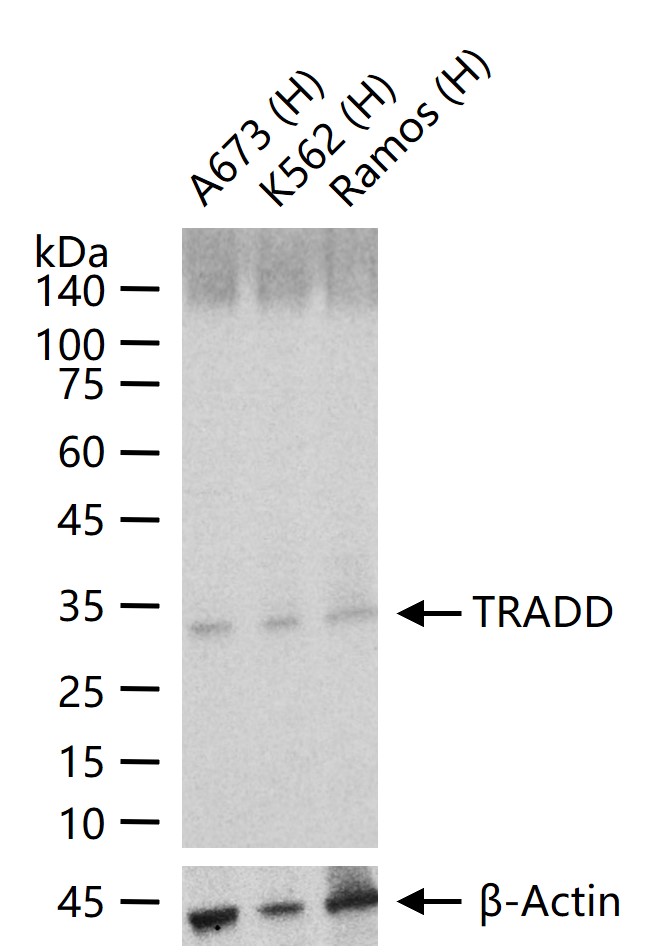 肿瘤坏死因子受体1相关死亡域蛋白重组兔单抗-bsm-61653R
