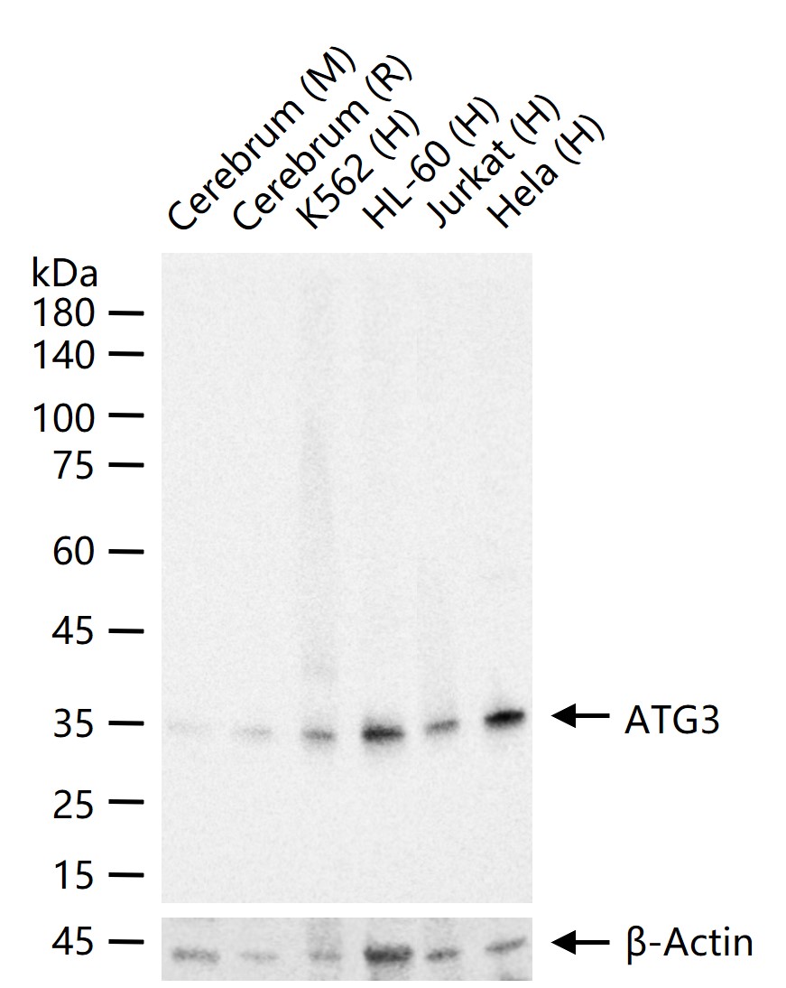 自噬相关蛋白3重组兔单抗