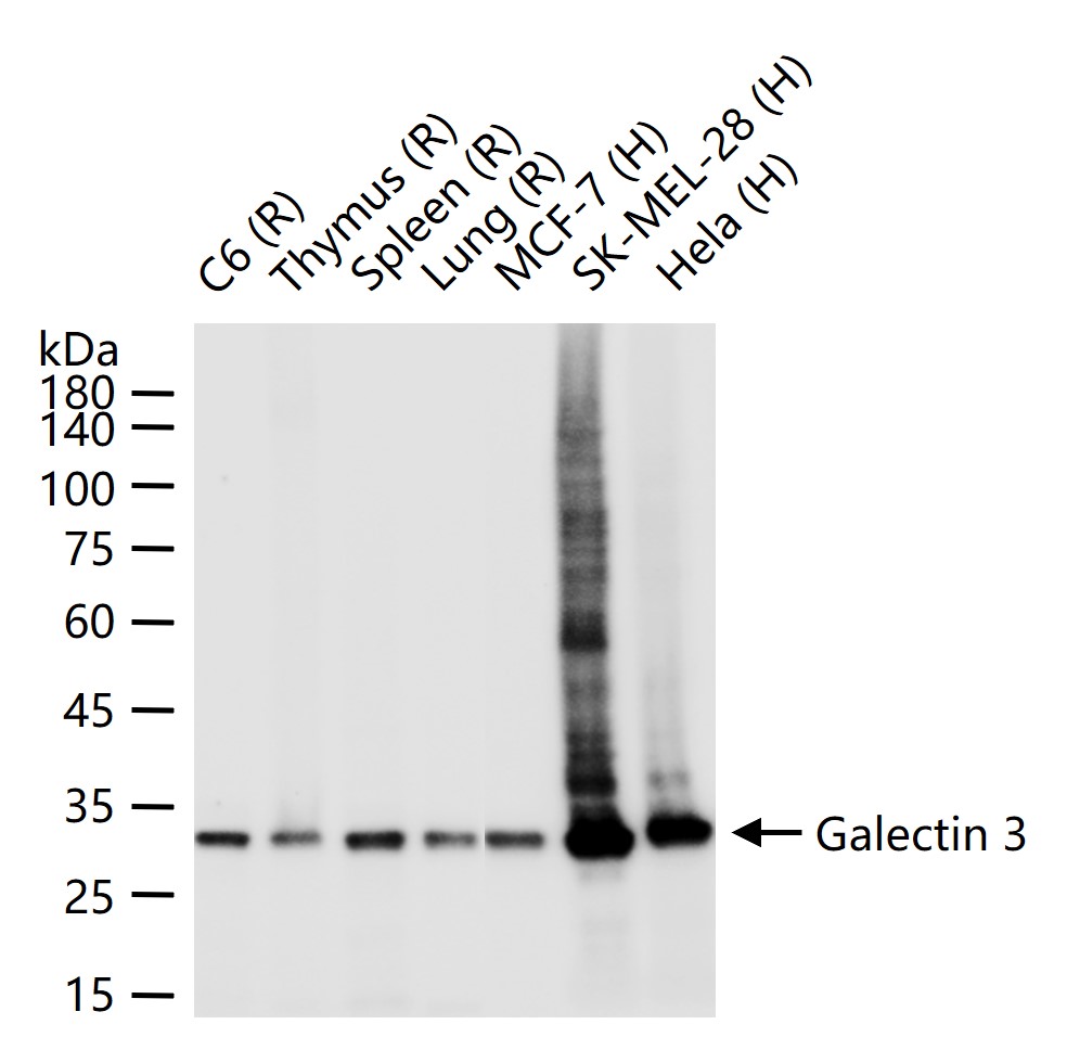 半乳糖凝集素3重组兔单抗