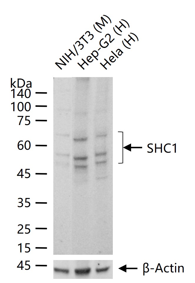 SHC1 Recombinant Rabbit mAb (一抗) - WB,IHC-P,IHC-F,IF | Bioss