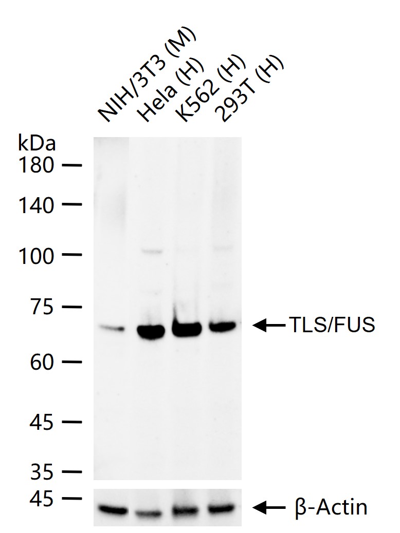 粘液样脂肪肉瘤蛋白FUS1重组兔单抗