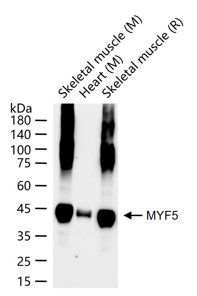 生肌决定因子Myf5重组兔单抗