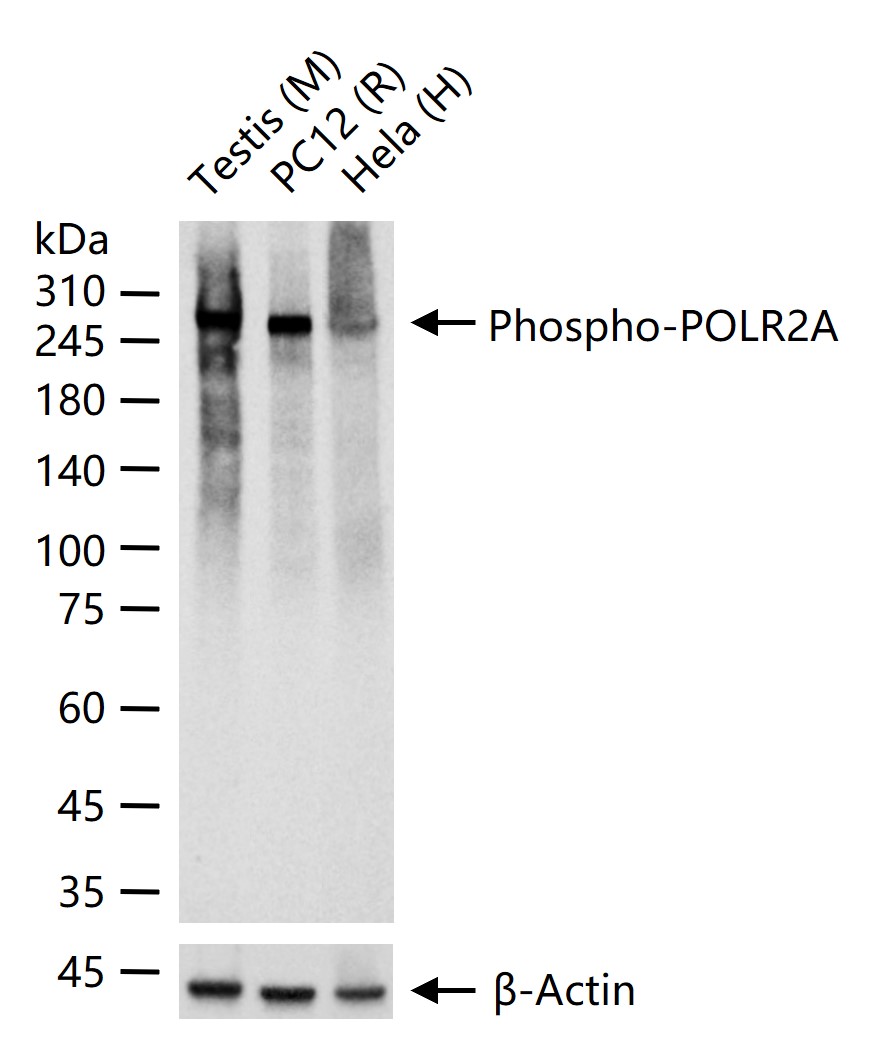 磷酸化RNA聚合酶II CTD重组兔单抗