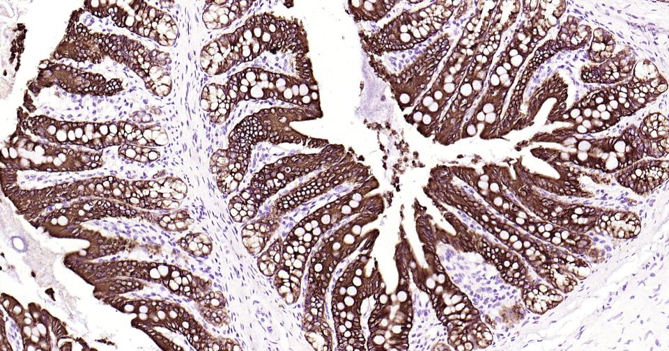 细胞角蛋白19重组兔单抗