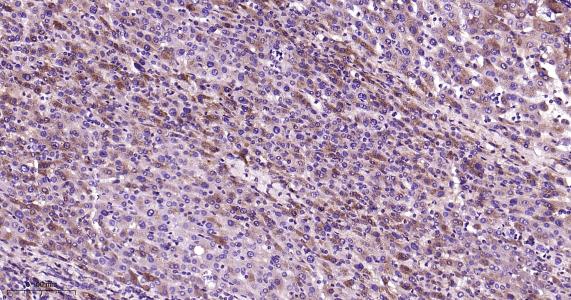 瞬时受体电位离子通道蛋白7重组兔单抗（M亚家族）