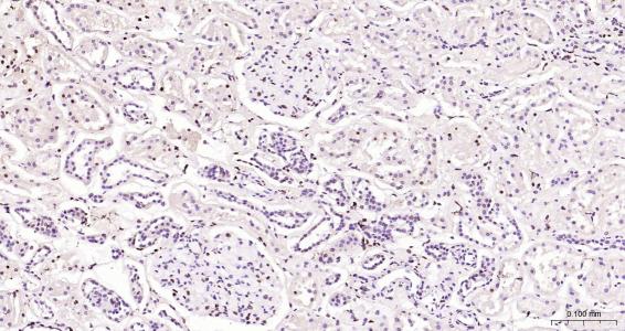 核纤层蛋白B（核内参）单克隆抗体-bsm-33040M