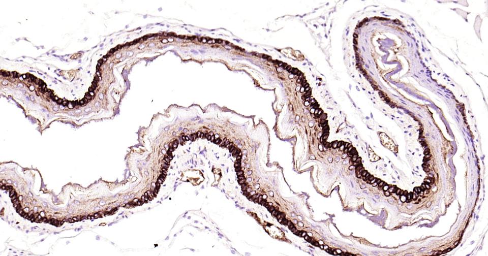 细胞角蛋白14重组兔单抗