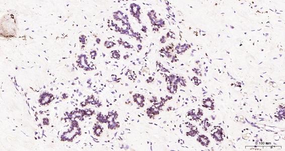 核纤层蛋白B（核内参）单克隆抗体-bsm-33040M