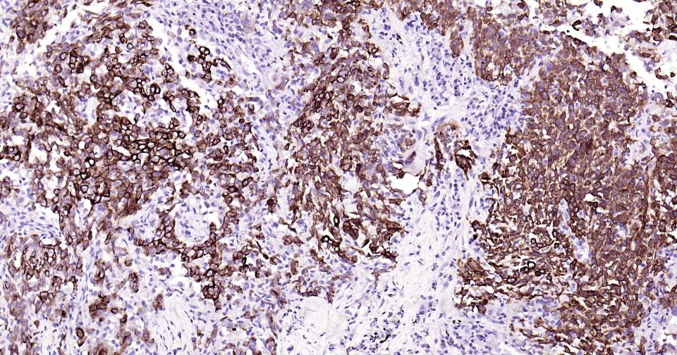 细胞角蛋白19重组兔单抗