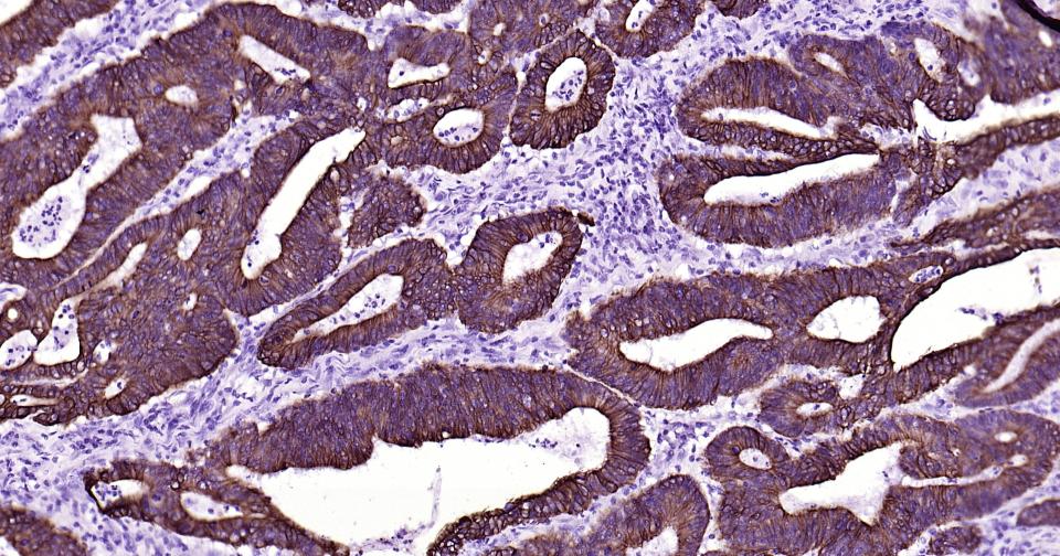 细胞角蛋白19重组兔单抗