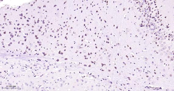 瞬时受体电位离子通道蛋白7重组兔单抗（M亚家族）