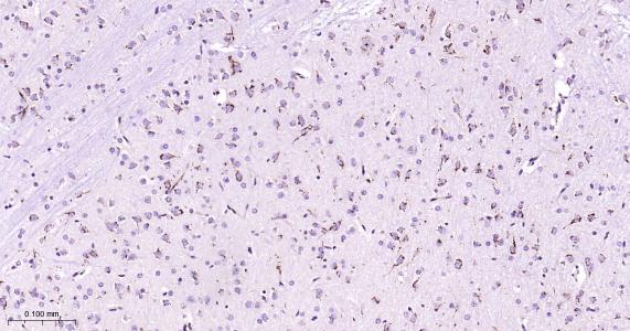 瞬时受体电位离子通道蛋白7重组兔单抗（M亚家族）