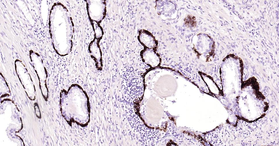 细胞角蛋白14重组兔单抗