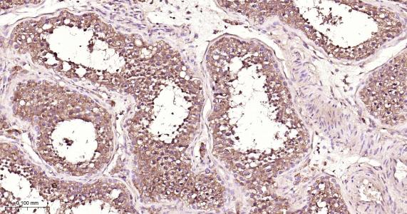 蛋白二硫异构酶A6重组兔单抗-bsm-61392R