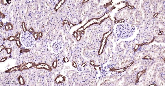 磷脂酰乙醇胺结合蛋白1重组兔单抗-bsm-61243R