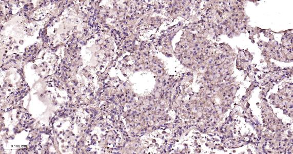 瞬时受体电位离子通道蛋白7重组兔单抗（M亚家族）