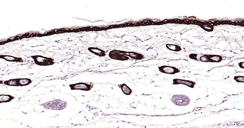 细胞角蛋白14重组兔单抗