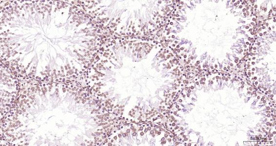 核纤层蛋白B（核内参）单克隆抗体-bsm-33040M