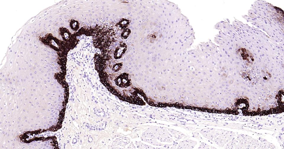 细胞角蛋白14重组兔单抗