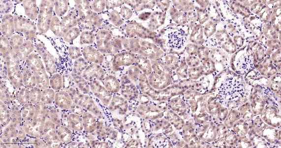 磷脂酰乙醇胺结合蛋白1重组兔单抗-bsm-61243R