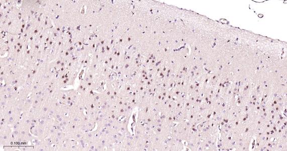 粘液样脂肪肉瘤蛋白FUS1重组兔单抗
