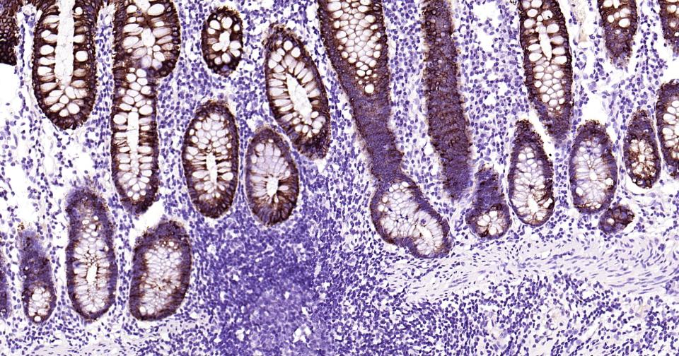 细胞角蛋白19重组兔单抗
