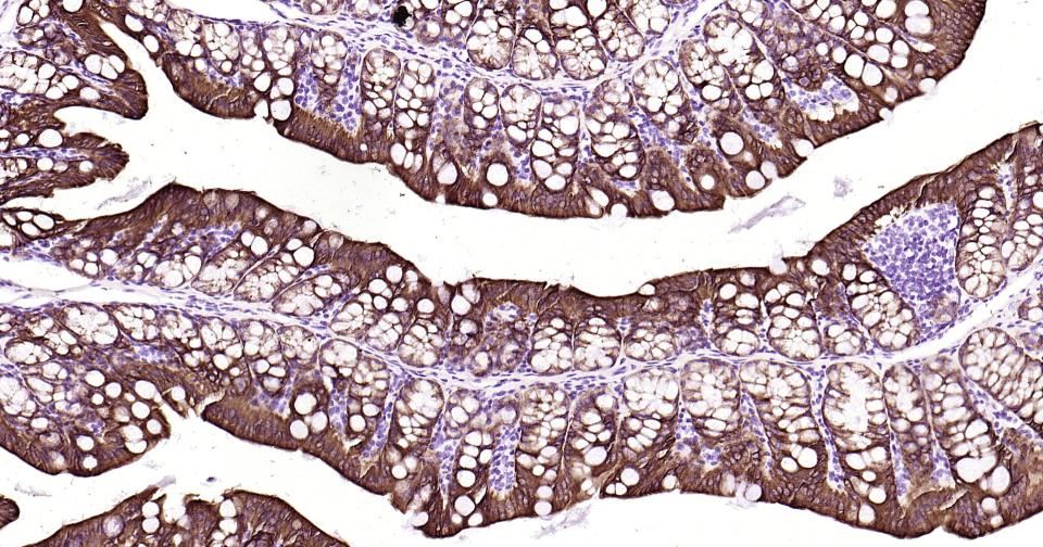 细胞角蛋白19重组兔单抗