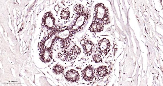 粘液样脂肪肉瘤蛋白FUS1重组兔单抗