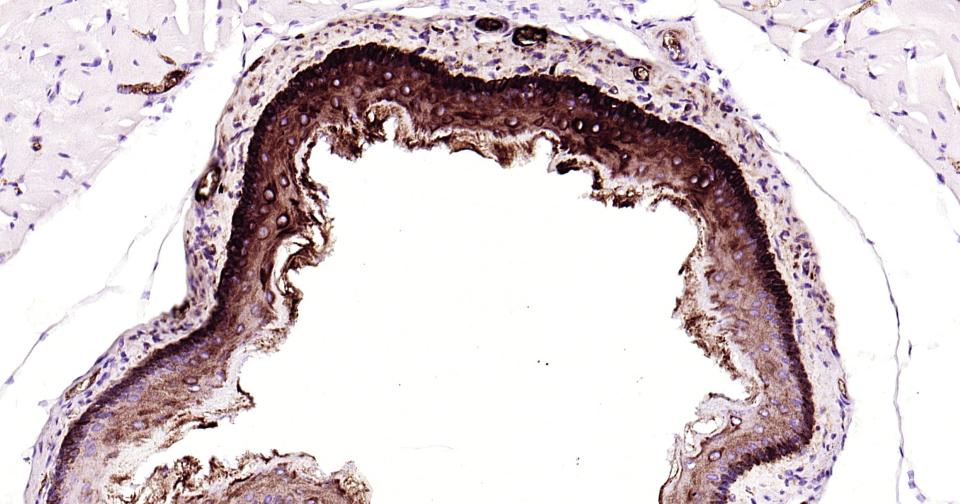 细胞角蛋白14重组兔单抗