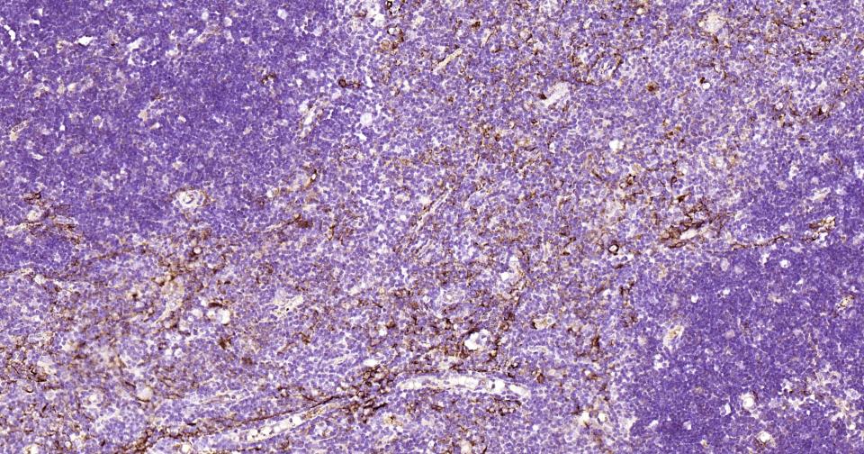 细胞角蛋白14重组兔单抗