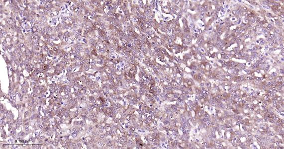 磷脂酰乙醇胺结合蛋白1重组兔单抗-bsm-61243R