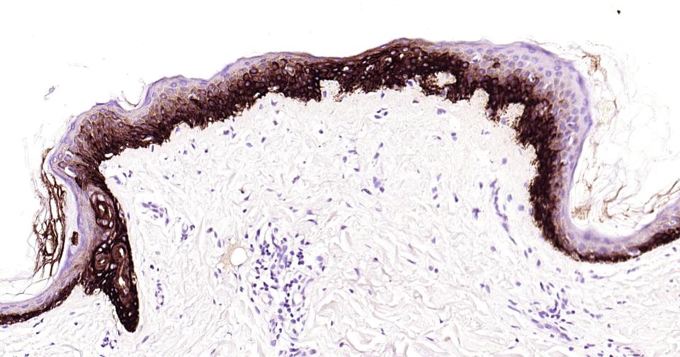 细胞角蛋白14重组兔单抗