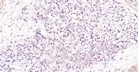 粘液样脂肪肉瘤蛋白FUS1重组兔单抗