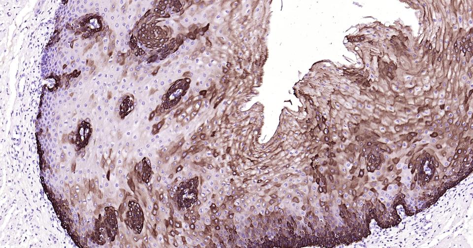 细胞角蛋白19重组兔单抗