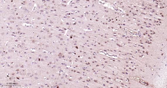 磷脂酰乙醇胺结合蛋白1重组兔单抗-bsm-61243R