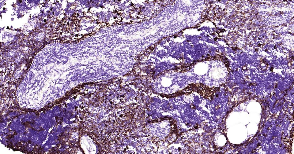 细胞角蛋白14重组兔单抗