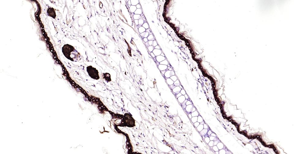 细胞角蛋白14重组兔单抗
