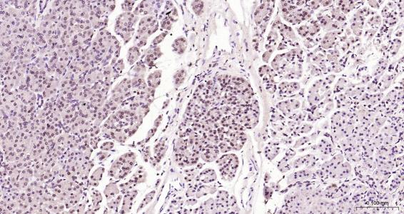 核纤层蛋白B（核内参）单克隆抗体-bsm-33040M