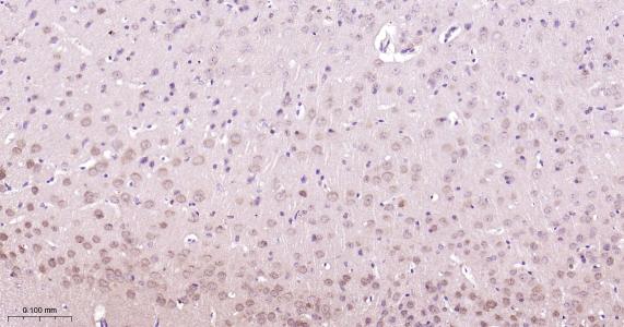 磷脂酰乙醇胺结合蛋白1重组兔单抗-bsm-61243R