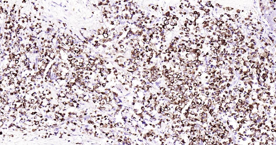 细胞角蛋白19重组兔单抗