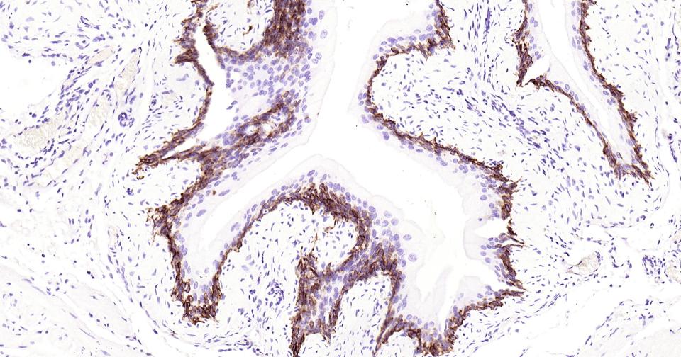 细胞角蛋白5重组兔单抗