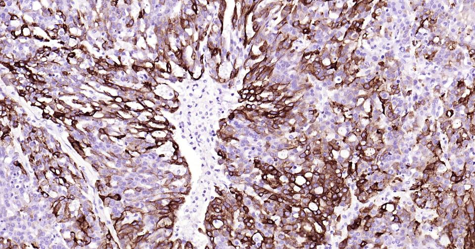 细胞角蛋白5重组兔单抗