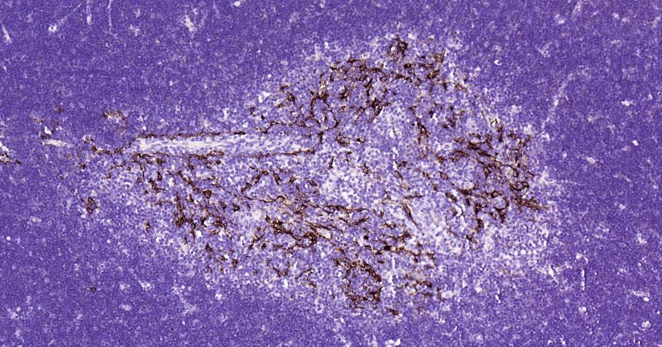 细胞角蛋白14重组兔单抗