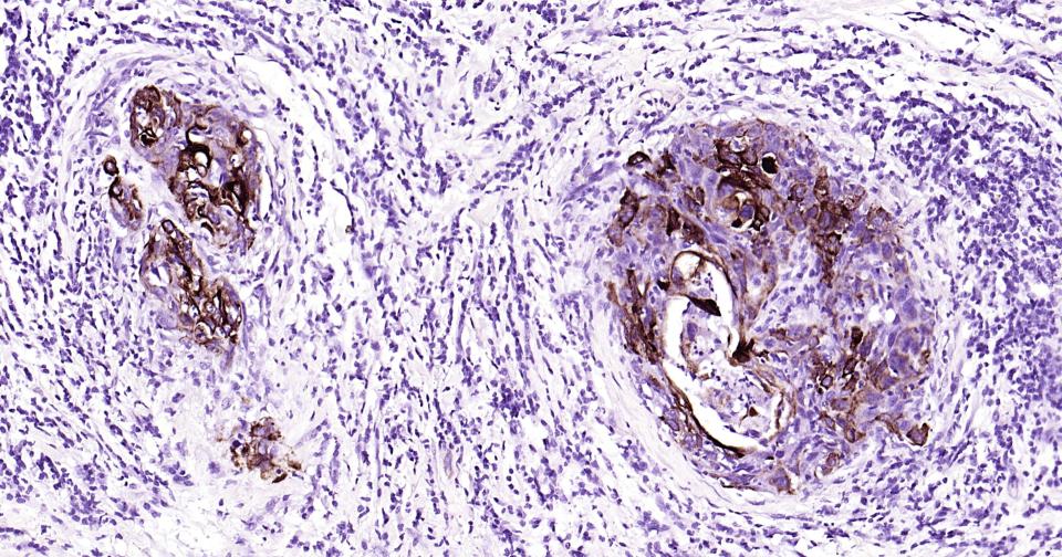细胞角蛋白14重组兔单抗