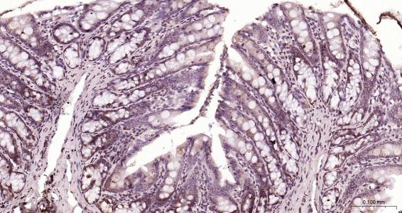 核纤层蛋白B（核内参）单克隆抗体-bsm-33040M