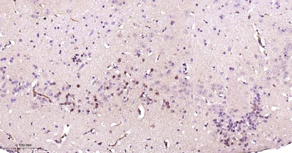 粘液样脂肪肉瘤蛋白FUS1重组兔单抗