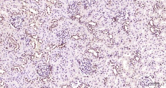 核纤层蛋白B（核内参）单克隆抗体-bsm-33040M