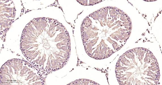 蛋白二硫异构酶A6重组兔单抗-bsm-61392R