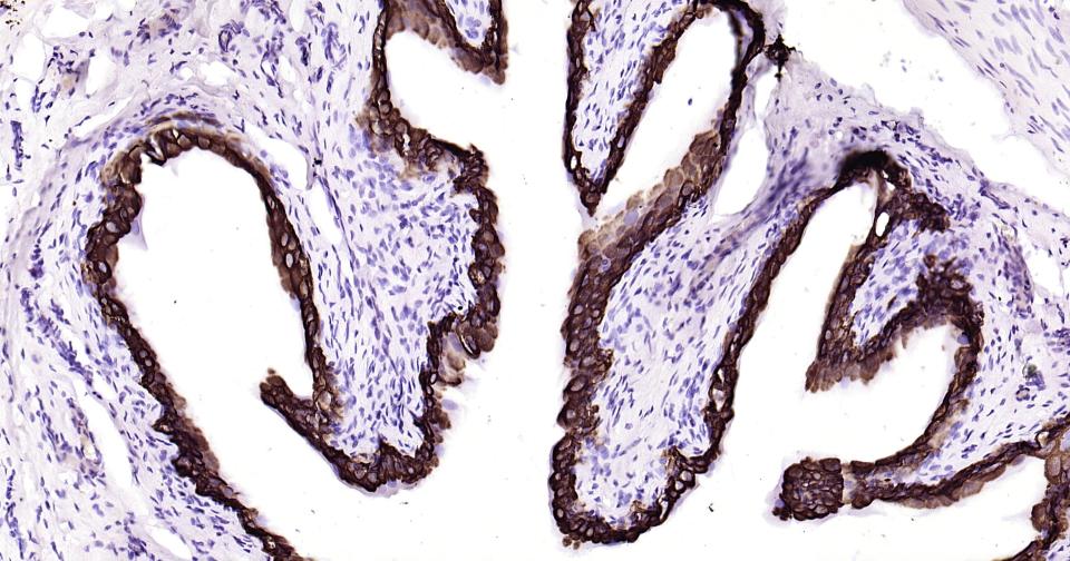 细胞角蛋白19重组兔单抗